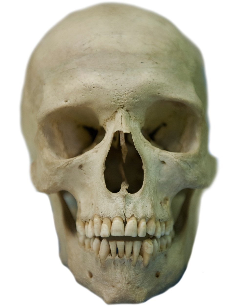 Skull Homo sapiens